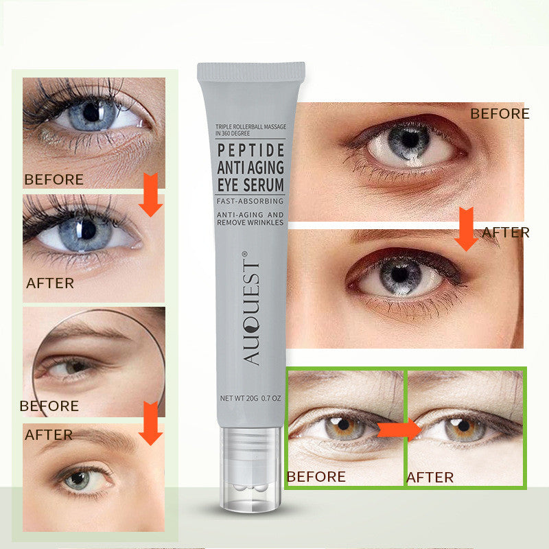 Anti-aging Augencreme® (1+1 GRATIS) | Frischeres und jüngeres Aussehen!